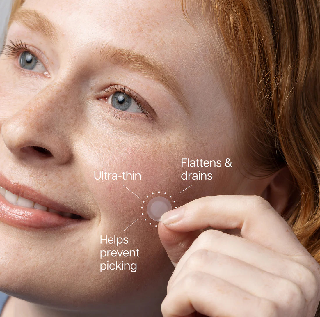 Face Reality: Hydrocolloid spot patches